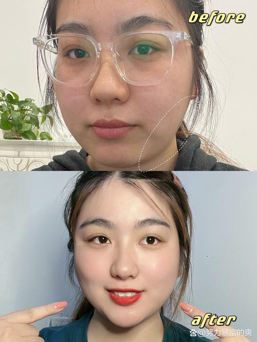 瘦了35斤的面部变化,瘦了35斤的面部变化图片
