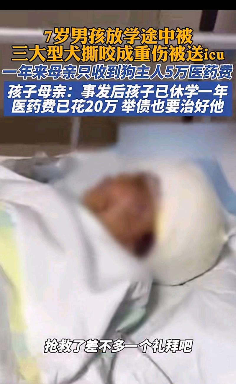 7岁男孩遭3只犬撕咬,7岁男孩遭3只犬撕咬怎么办